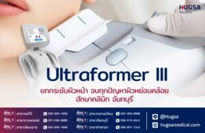 Ultraformer lll