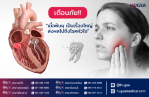 ฟันผุถึงหัวใจ